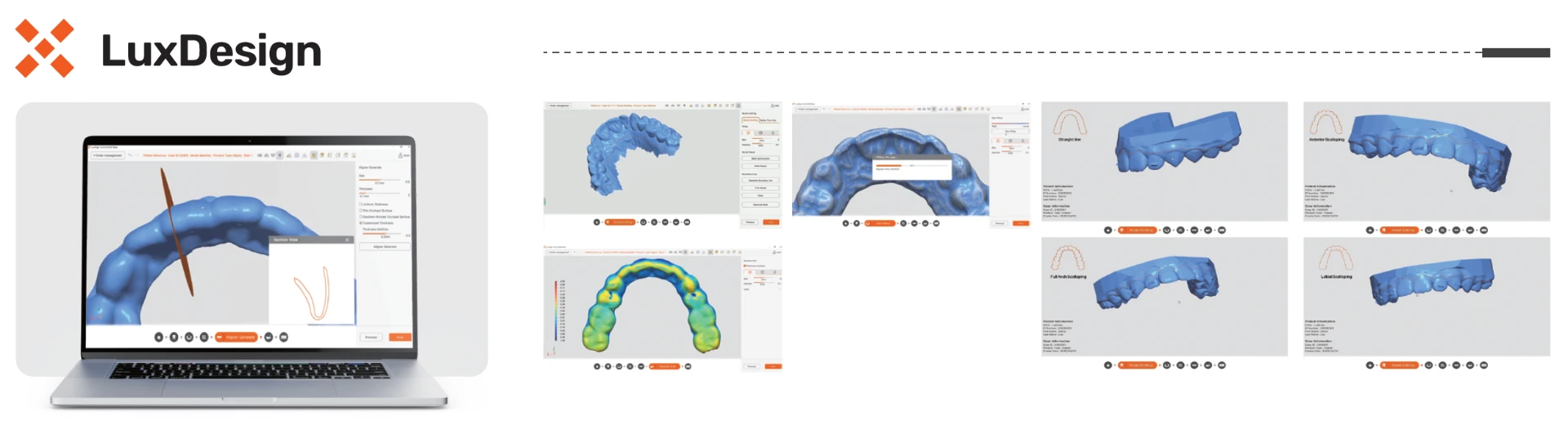 Entorno del software LuxDesign para el diseño digital de aparatos de ortodoncia